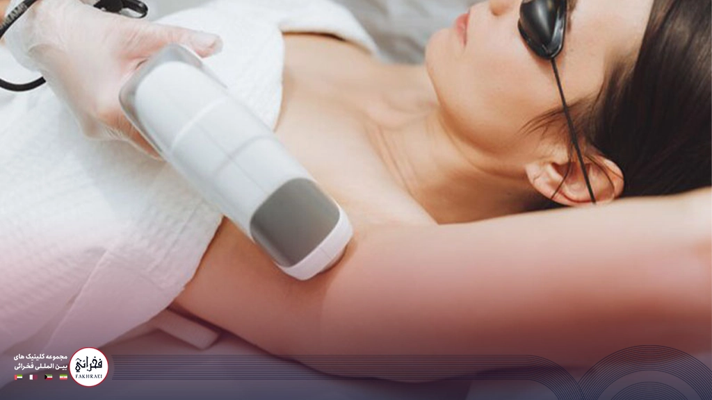 لیزر کیوسوئیچ برای زیر بغل- زنی در حال انجام لیزر زیر بغل