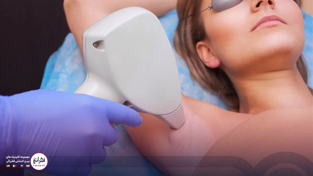 لیزر کیوسوئیچ برای زیر بغل- زنی در حال انجام لیزر زیر بغل