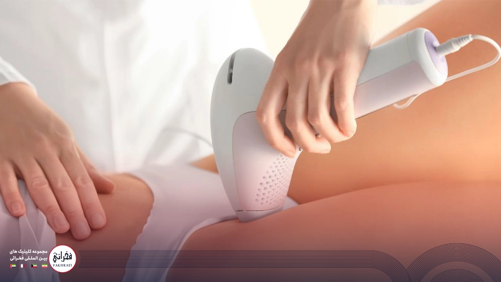 لیزر CO2 بیکینی- زنی در حال لیزر پای خود