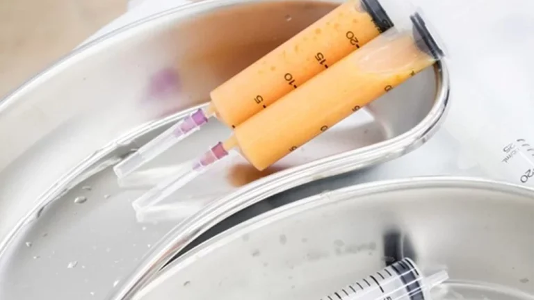 تزریق چربی به شقیقه، مزایا + معایب