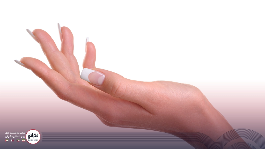 تزریق ژل دست-دستی با مانیکور سفید