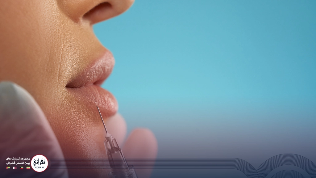 تزریق ژل لب مدل صدفی-در حال تزریق ژل لب