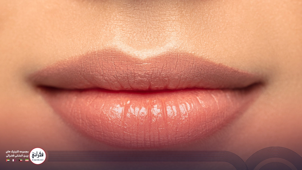 تزریق ژل لب مدل صدفی-تصویر لب خانومی