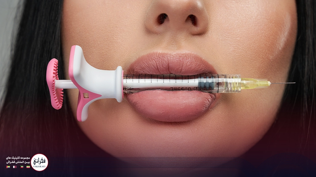تزریق ژل لب مدل قلوهای-سرنگی داخل لب های خانمی