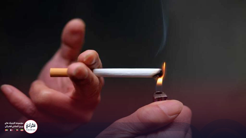 چرا نباید بعد از کاشت مو سیگار کشید