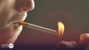 سیگار بعد از کاشت مو