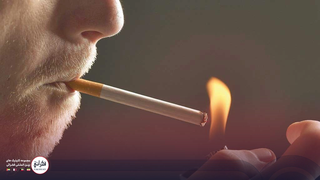 سیگار بعد از کاشت مو