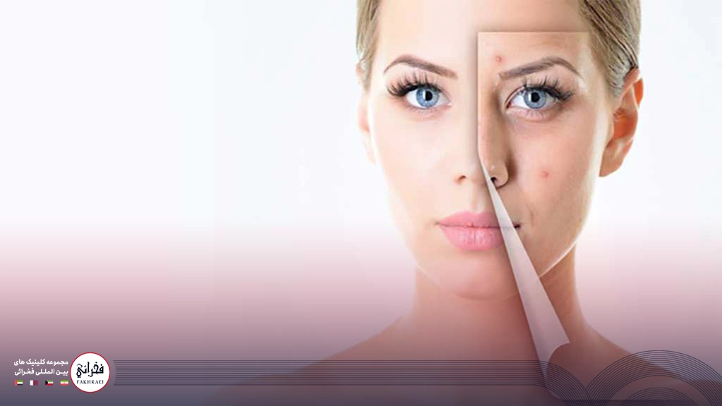 مقایسه لیزر CO2 با سایر روش‌ها برای درمان لک صورت