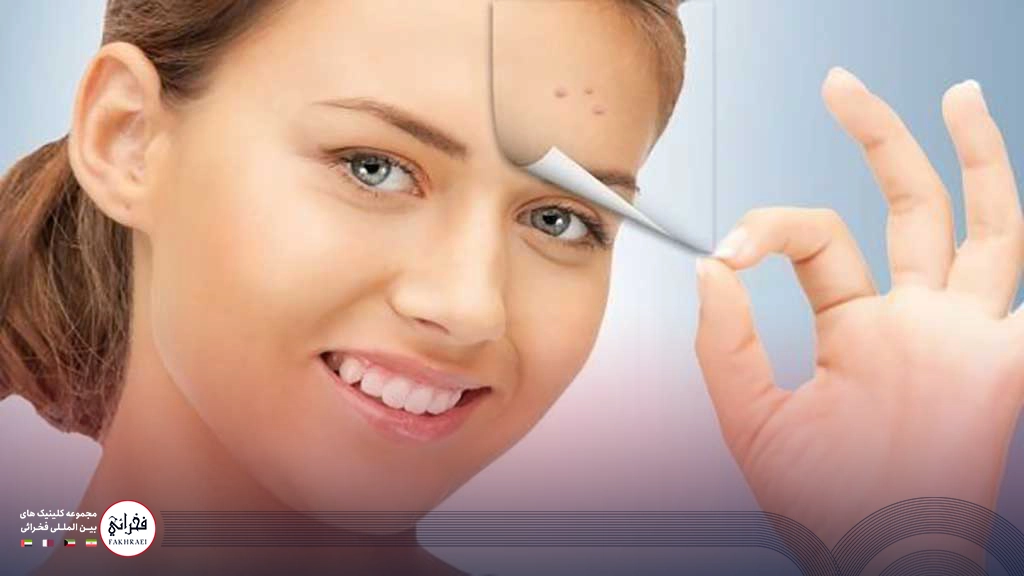 مراقبت‌های بعد از لیزر CO2 برای لک صورت