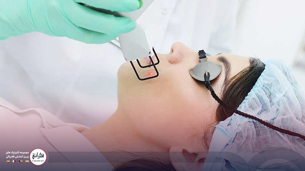 هزینه لیزر CO2 برای لک صورت