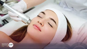 مراقبت های لیزر فوتونا- زنی در حال انجام لیزر