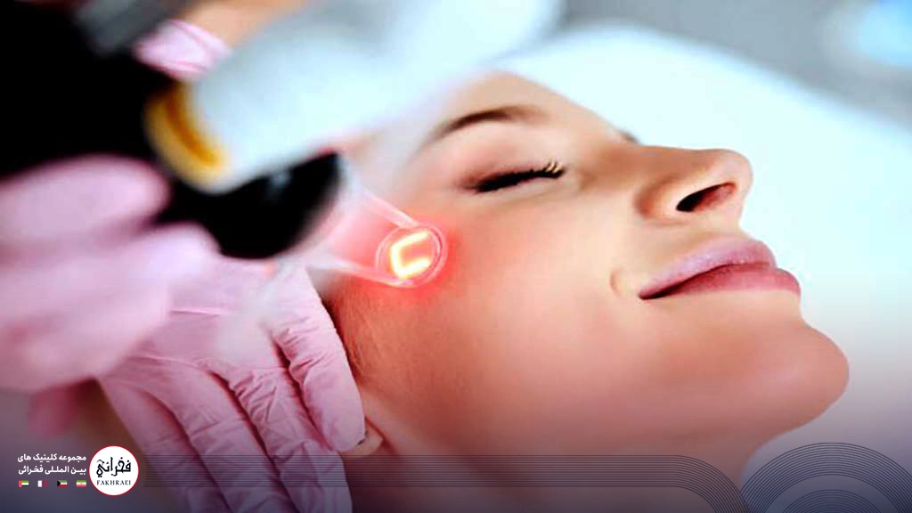 مدت ماندگاری لیزر فرکشنال co2