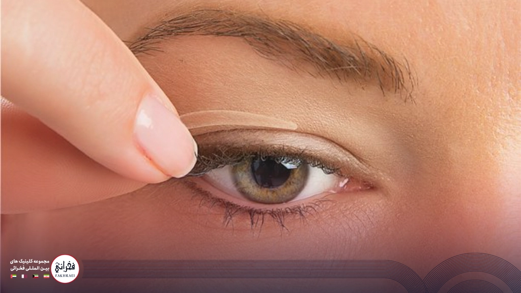 هایفوتراپی پلک-پشت پلک زنی