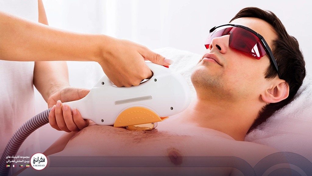 لیزر موهای زائد آقایان
