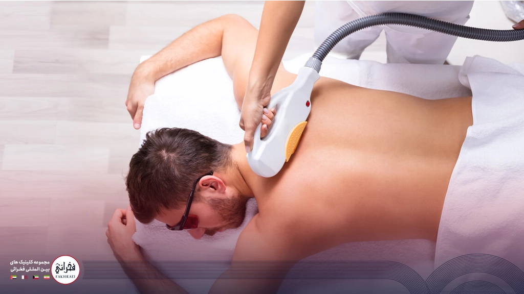 لیزر موی زائد مردان