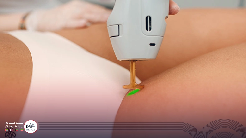 از بین بردن موهای زائد بیکینی با لیزر کندلا