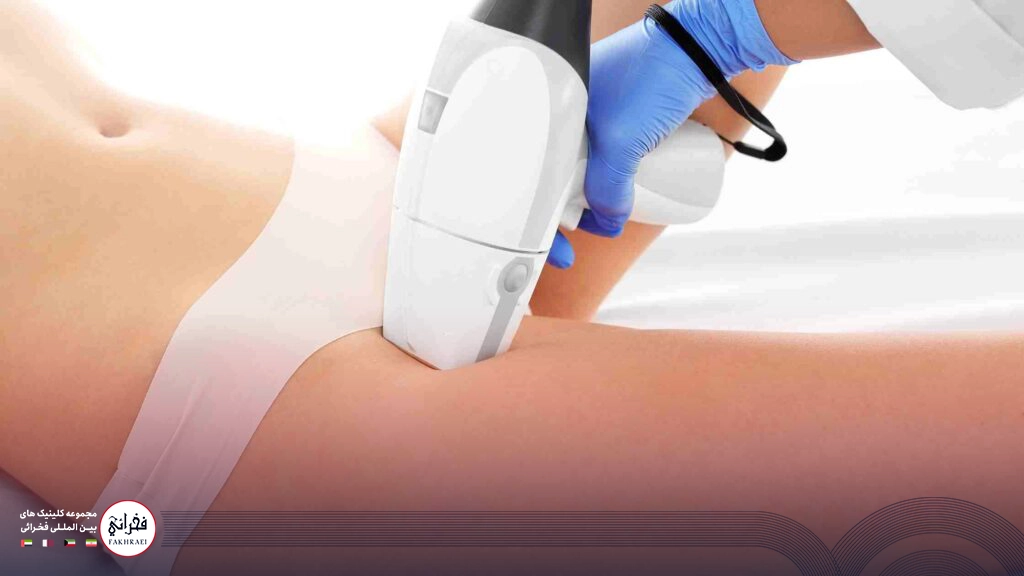  لیزر موهای زائد بیکینی چیست؟