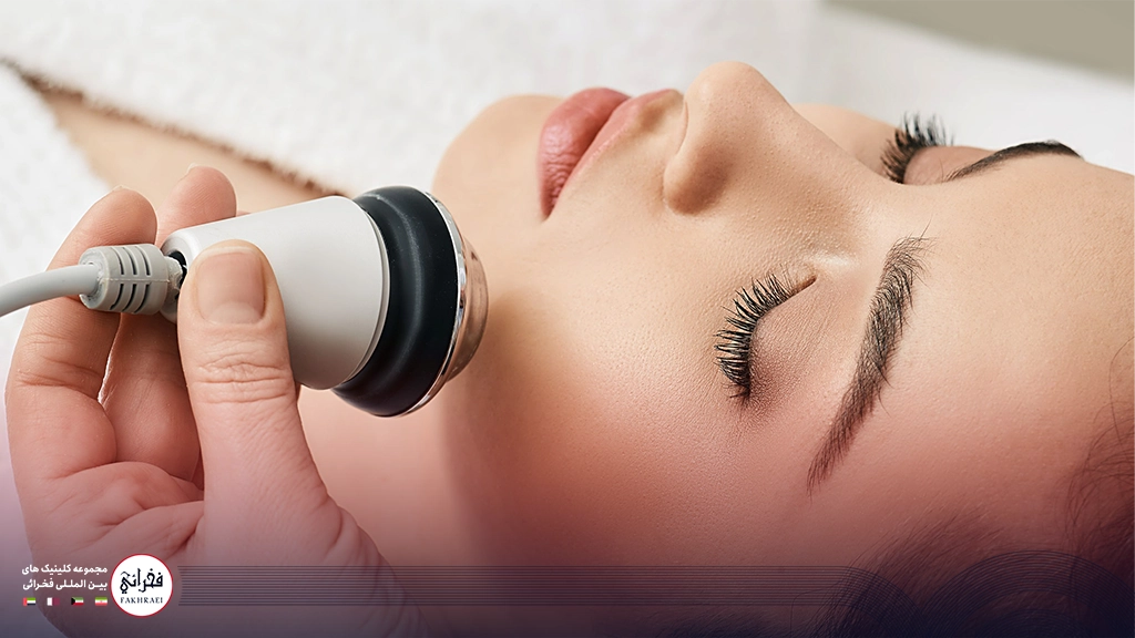 تفاوت لیزر rf با لیزر CO2-زنی در حال انجام لیزر RF