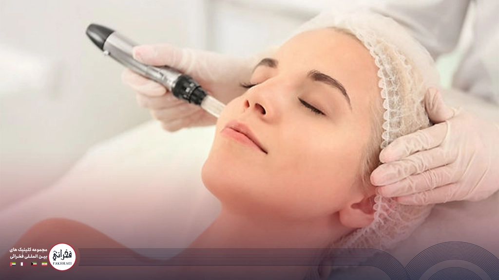 میکرونیدلینگ بهتر است یا لیزر co2-زنی در حال میکرونیدلینگ