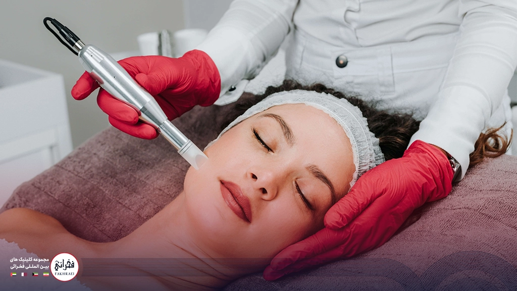 میکرونیدلینگ بهتر است یا لیزر co2-زنی در حال انجام میکرونیدلینگ