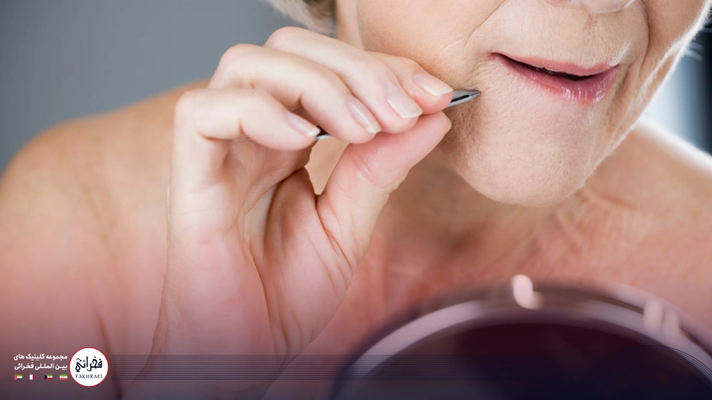 از بین بردن موهای زائد چانه بدون لیزر