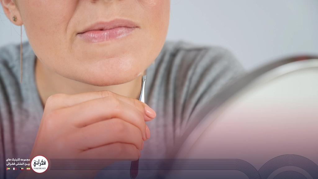 موهای زائد زیر چانه را چگونه از بین ببریم