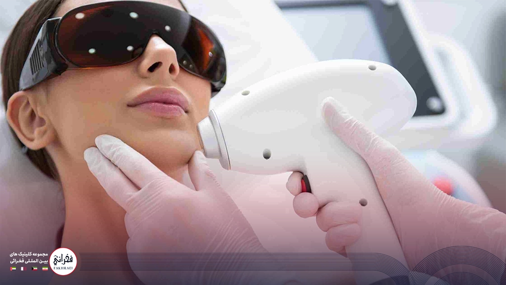 لیزر موهای زائد چانه