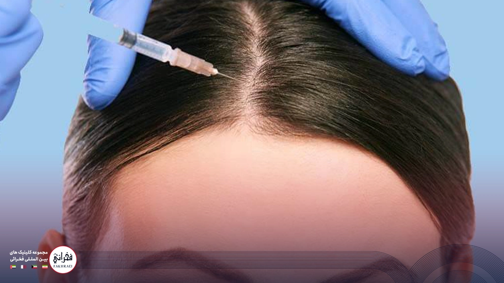 کاربرد‌های مزوتراپی مو