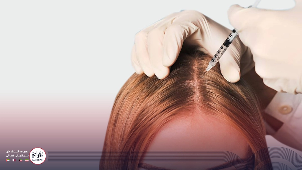 مزوتراپی مو چیست؟