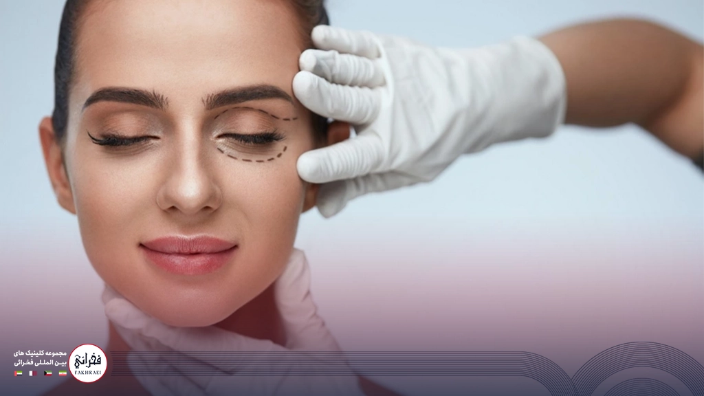 هایفوتراپی صورت-صورت خانومی با چشمان بسته و زیر چشم خط کشی شده