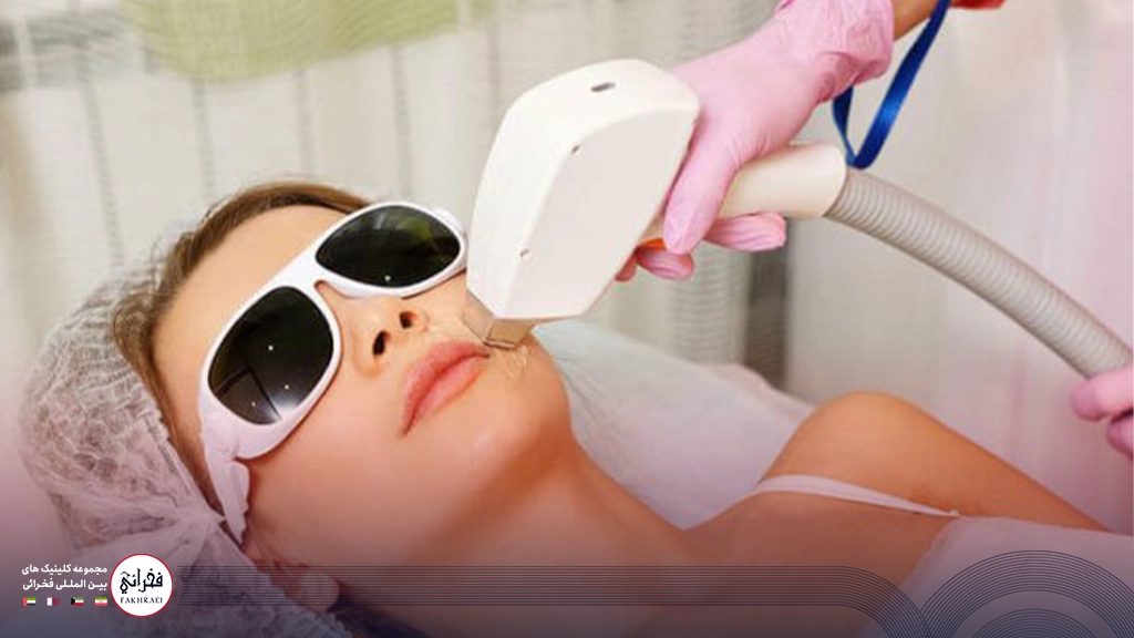 هایفوتراپی صورت-زنی در حال انجام هایفو