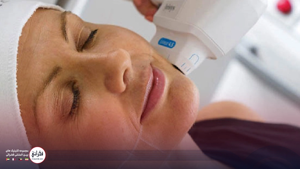 هایفوتراپی صورت-هایفو صورت خانوم مسنی