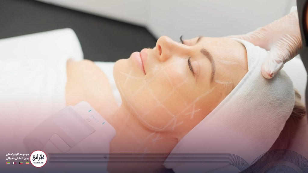 هایفوتراپی صورت-هایفو غبغب خانومی