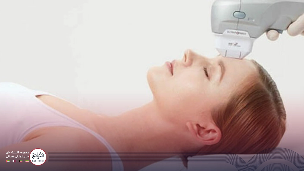 هایفوتراپی صورت-هایفو روی پیشانی خانمی