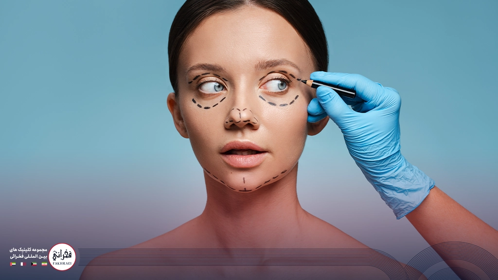 قبل از بلفاروپلاستی زیر چشم خانومی خط کشی شده