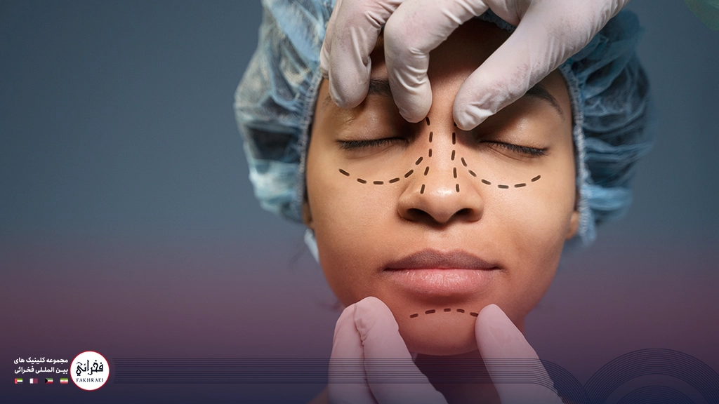 بلفاروپلاستی زنی با چشمان بسته و خط کشی شده