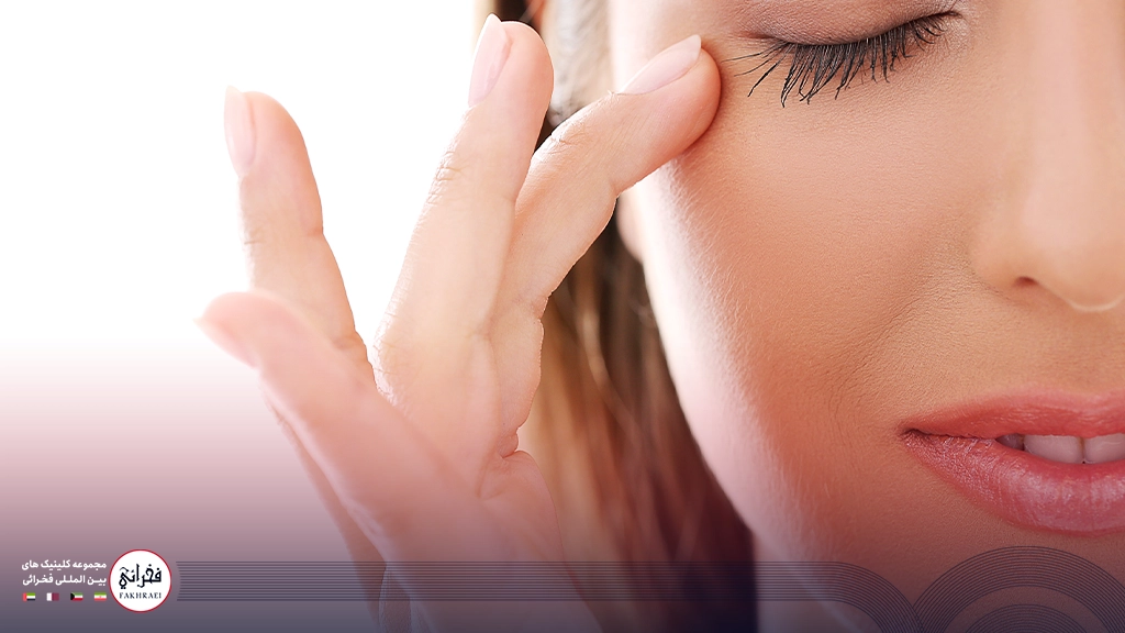 بلفاروپلاستی برای چشم زنی که افتاده