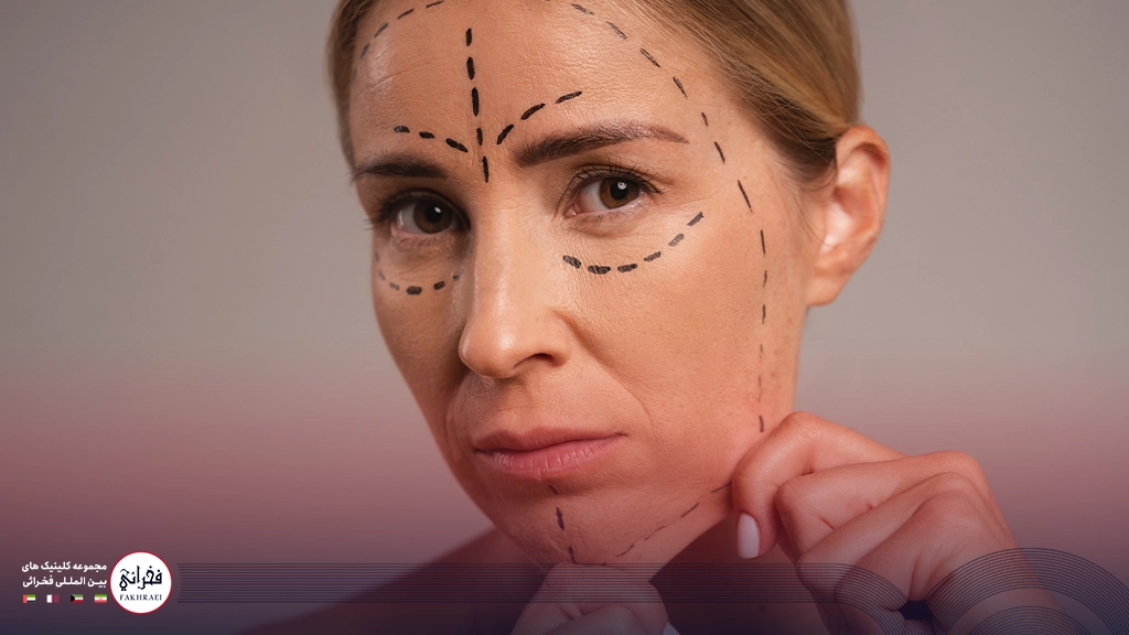 بلفاروپلاستی زنی با صورت خط کشی شده