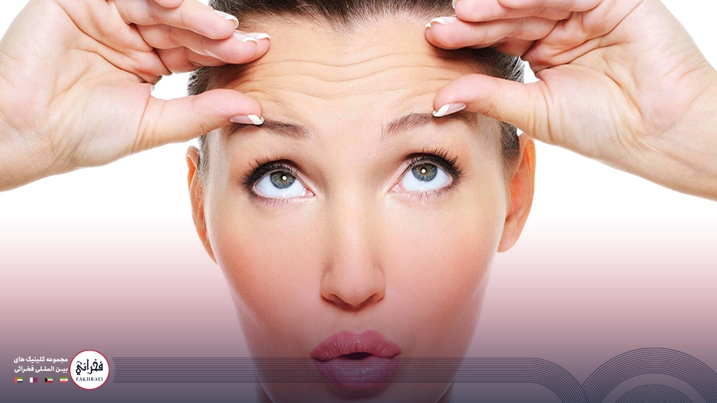 بوتاکس پیشانی-زنی بصورت اخم کرده با پیشانی چروک