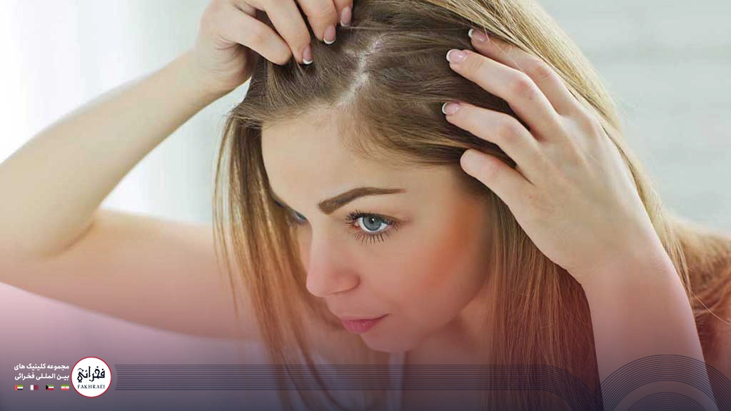 آیا کاشت مو برای زنان جواب می دهد؟