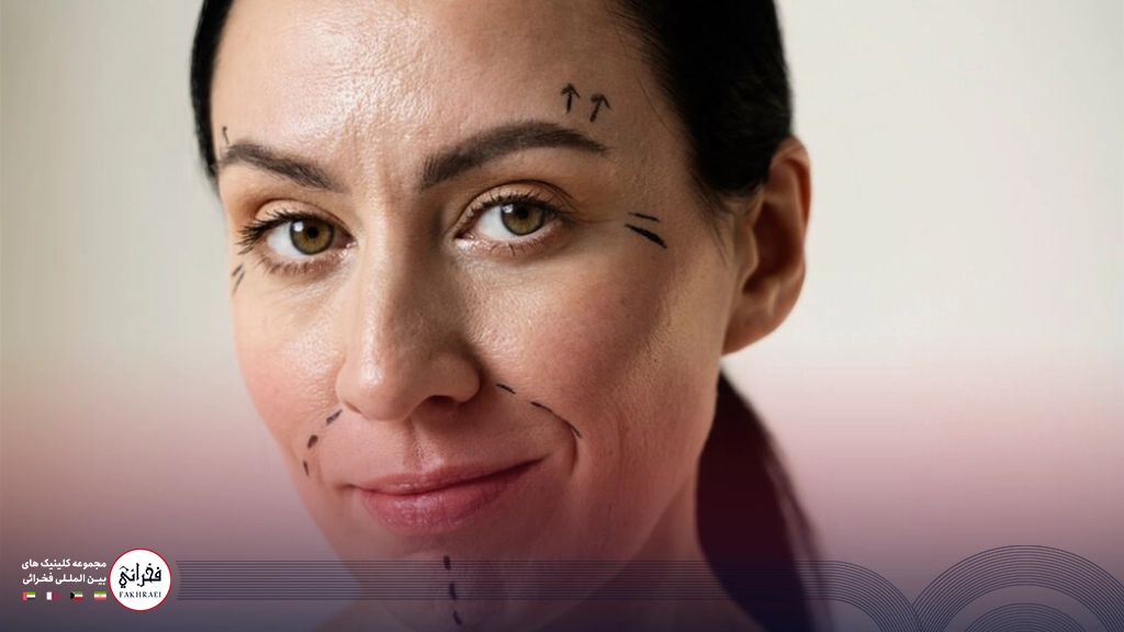 لیفت شقیقه با نخ-خانومی با موی مشکی و خط کشی بالای ابرو