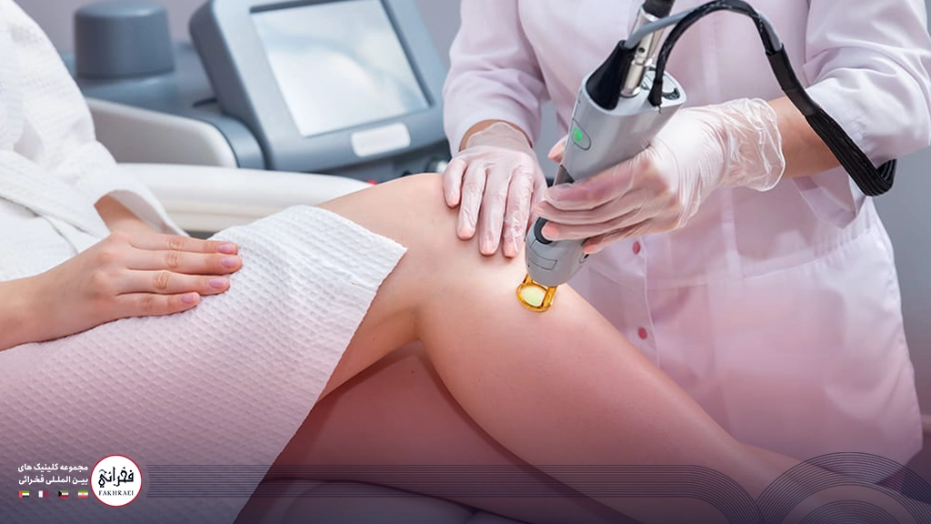 لیزر سایناشور بهتر است یا کندلا؟-در حال انجام لیزر پای خانومی