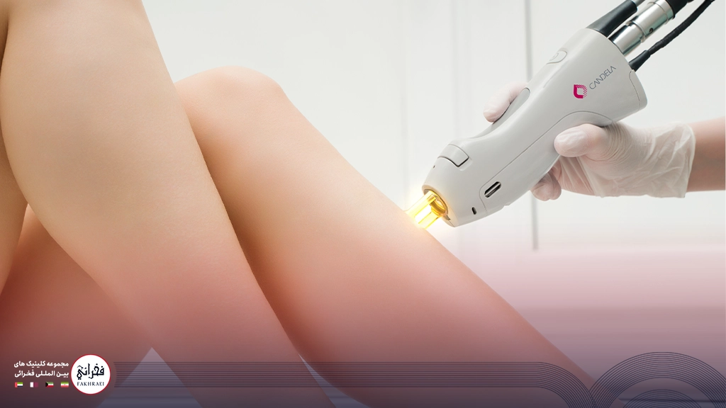 لیزر سایناشور بهتر است یا کندلا؟-در حال انجام لیزر موهای زائد پا