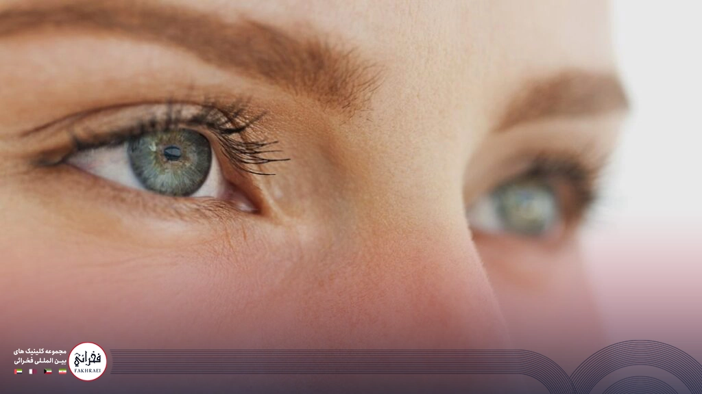 مزوتراپی زیر چشم-چشمان سبز خانومی