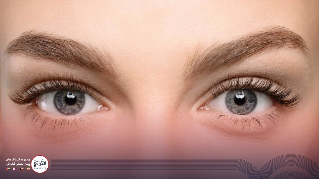 لیفت ابرو با نخ-تصویر خانومی با ابروهای بور