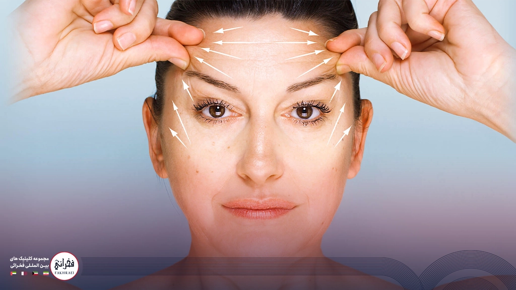 لیفت ابرو با نخ-تصویر خانومی که با دست ابروهایش را بالا آورده است