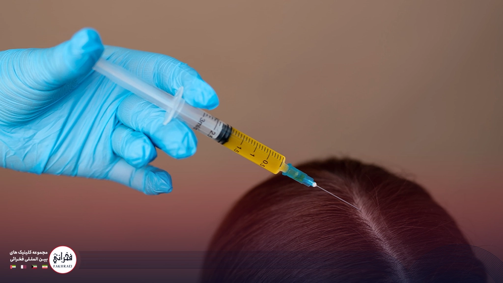 پی آر پی مو-تزریق به کف سر خانومی