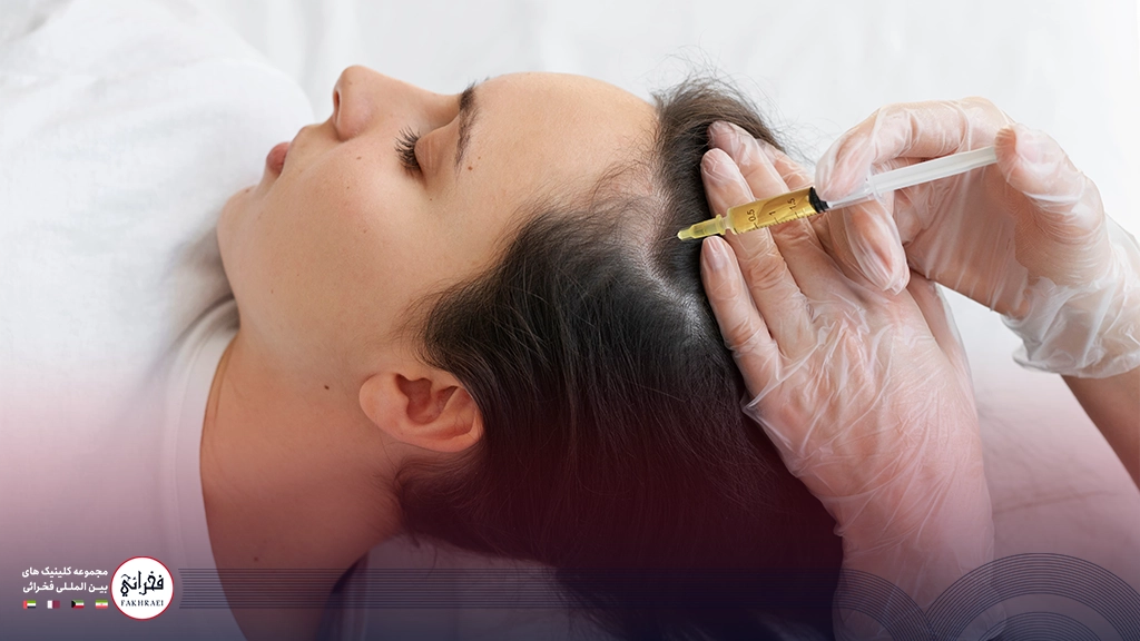 پی آر پی مو-تزریق به کف سر خانومی