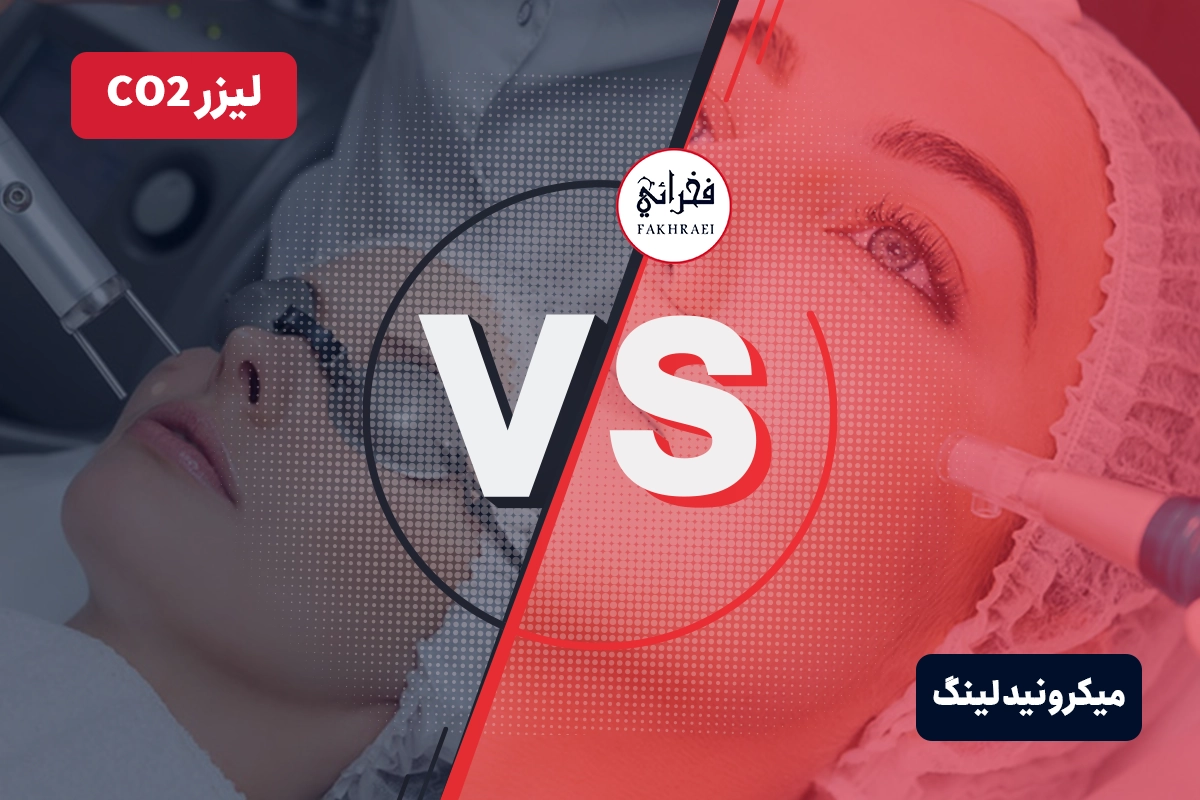 میکرونیدلینگ بهتر است یا لیزر co2