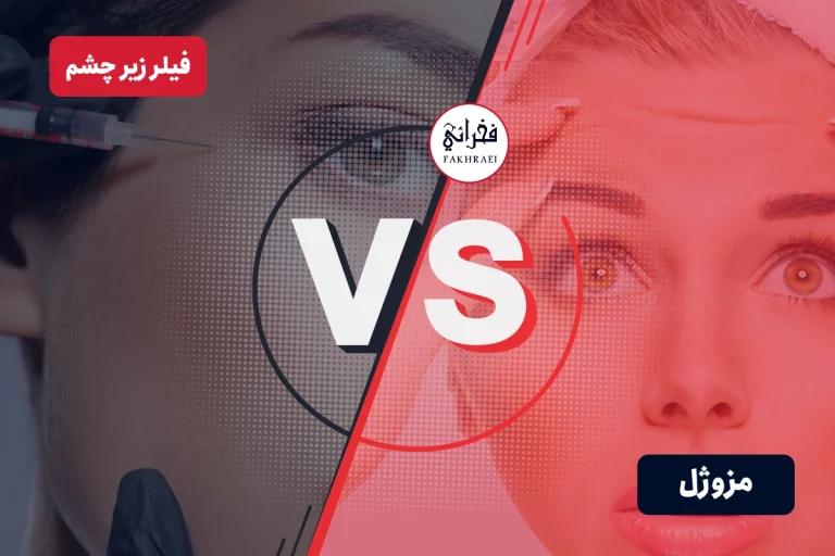 فرق مزوژل با فیلر زیر چشم: کدام روش برای شما بهتر است؟